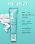Bliss Clear Genius Acne Spot Treatment – Maximum Strength 2% Salicylic Acid Shrinks Blemishes – Clean, Vegan, Cruelty-Free, 0.5 Fl Oz