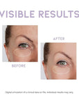 Eye cream for dark circles