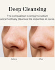 Pure Deep Cleansing Balm 3.38 oz | Makeup remover balm | Korean Skin care | Vegan Pore cleanser | Natural Deep Cleansing Balm for Sensitive & Dry skin