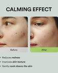 Abib Heartleaf Spot Pad Calming Touch 80pads 5.07 fl.oz. | Korean Acne Soothing Toner Pads for Face, Cleansing, Disposable, Exfoliant, Skin Care