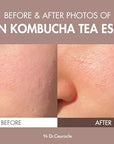 Dr.Ceuracle Vegan Kombucha Cream Essence Toner - Korean Skincare Hydrating Milky Toner with Kombucha Tea Extract, Centella Asiatica, Ceramide (150 ml / 5.07 fl. oz.)
