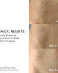 Evereden Golden Belly Serum, 1.7 fl