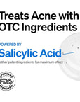 FRONTMAN Fade, Men's Acne Concealer With Salicylic Ac
