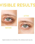 Dark circle remover eye serum,
