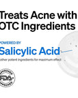 FRONTMAN Fade, Men's Acne Concealer With Salicylic Ac