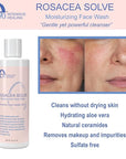 Rosacea solve moisturizing face wash