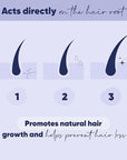 MOERIE Ultimate Hair Growth Serum for Natural Hair Regrowth & Thickening - Anti Thinning & Hair Loss Treatment for Women - Rapid Hair Growth Products - Scalp Oil Alternative - 1.69 fl oz / 50 ml