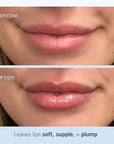 First Aid Beauty - Ultra Repair Lip Balm, Instant Hydration and Moisture for Soft, Supple & Plump Lips, Concentrated Formula of Botanical Oils, Butters & Waxes, Cruelty Free, 0.25 oz