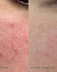 DIME Beauty Super Skin Toner, Alcohol-Free Hydrating