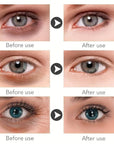 Magic eye cream for dark