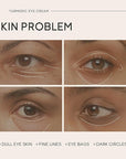 Turmeric under eye cream, for