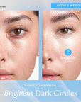 belif Aqua Bomb Cooling Eye Gel - Caffeine & Hyaluronic Acid for Puffiness & Hydration, Niacinamide & Vitamin C for Dark Circles, Adenosine & Collagen for Plumping & Firming, Korean Skin Care