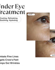 Matkas korean retinol eye cream
