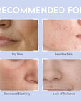 Collagen Hydrating Sheet Masks for Face Korean Anti Hazel 10EA
