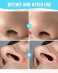 2025 New 2 in 1 Nasal Hair Cutter, Double Sided Nose Hair Knife Nostril Hair Remover Tool, Manual 360° Rotating Nose Hair Trimmer, Mini Noses Hair Remover Tool for Women and Men (Green, 6 Pcs)