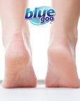Blue Goo Cracked Heels & Dry Hands Intense Skin Softener - for Calluses, Corns & Elbow Dryness Relief, Fast- Penetrating Hydrating Moisturizer, Made w/ 100% Pure Emu Oil & Beeswax, 2 oz (2 Pack)