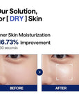 MEDIHEAL Watermide Moisture Pad - Square Cotton Facial Toner Pads with Icelandic Glacial Water - Improve Skin Temperature, Hydrating to Dry, Puffy, Coarse Skin -Vegan Eco Silk,100 Pads