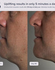 Pulsating Facial Lift | 5 Minute Age Reversal Device, Contours & Improves Facial Structures, Tightening & Toning of Skin