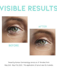Retinol eye cream serum for