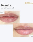 Ultra hydrating lip treatment moisturizer