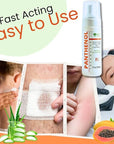 9% Panthenol Foam Spray, Vitamin B5 + Deep Moisturizing Hyaluronic Acid After Sun Care, After Tattoo Care, Hair Transplant & Baby Rash Relief, 5 Oz / 150 ml