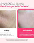 Dr.Melaxin Cemenrete Cyano Pink Spicule Serum with Calcium, pore tightening refines pores tightening serum 1.01 fl. oz.