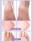 Toi:L Extra Silky Foot Mask 5 Pairs, Post-Peeling Foot Care Treatment, Moisturizing Socks with Guerande Salt & Sweet Almond Oil for Dry Feet, Cracked Heels, and Callus