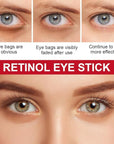 Retinol eye stick with collagen,hyaluronic