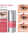 Retinol eye cream for dark