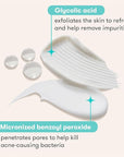 Proactiv 3 Step Acne Treatment w/ Pimple Patches - Benzoyl Peroxide Face Wash, Repairing Acne Spot Treatment for Face and Body, Exfoliating Toner - 90 Day Complete Acne Skin Care Kit + Pimple Patches