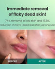 Dr.G Brightening Peeling Gel (120ml)