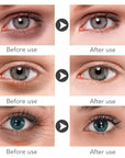 Magic retinol eye cream for