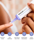 Hero Cosmetics Rescue Balm Post-Blemish Recovery Cream - Intensive Nourishing and Calming for Dry, Red-Looking Skin After a Blemish - Dermatologist Tested (50 ml, 1.69 fl. oz)