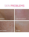 Skin Care, Skin Care Set, Skin