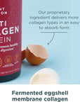 Ancient Nutrition Collagen Powder Protein with Probiotics, Unflavored Multi Collagen Protein with Vitamin C, 45 Servings, Hydrolyzed Collagen Peptides Supports Skin and Nails, Gut Health, 16oz