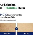 MEDIHEAL Teatree Trouble Facial Toner Pads with Tea Tree & Lactobacillus - Calming & Soothing for Sensitive & Acne Prone Skin - Vegan Face Gauze, 100 Pads