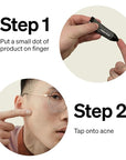 FRONTMAN Fade, Men's Acne Concealer With Salicylic Ac