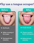 GuruNanda Tongue Scraper for Adults (4-Pack) with Travel Case, 420 Medical Grade Stainless Steel, Aids in Fresh Breath & Oral Care - Travel-Friendly
