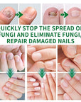 Ginger Nail Treatment, Nail Treatment,