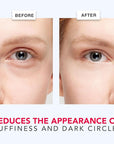 Caffeine eye cream for puffiness