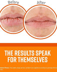 O'Keeffe's Unscented Lip Repair Lip Balm Lips,