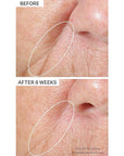 StriVectin Tighten & Lift Peptight Tightening