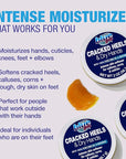 Blue Goo Cracked Heels & Dry Hands Intense Skin Softener - for Calluses, Corns & Elbow Dryness Relief, Fast- Penetrating Hydrating Moisturizer, Made w/ 100% Pure Emu Oil & Beeswax, 2 oz (3 Pack)