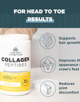 Ancient Nutrition Collagen Peptides, Collagen Peptides Powder, Vanilla Hydrolyzed Collagen, Supports Healthy Skin, Joints, Gut, Keto and Paleo Friendly, 12 Servings, 20g Collagen per Serving