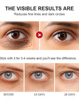 Retinol eye stick - with