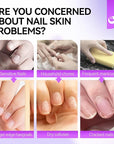 gelike ec Cuticle Care Balm for Nails: Grape Organic Cuticle Softener to Nourish Moisturize Remove Restore Strengthen Dry & Splitting Cuticles