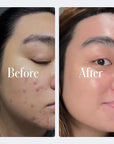 Geologie Clear System | 3-Step Acne