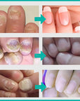 MIELIKKI Nail Repair Cream, Nail