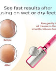 Microplane Colossal Foot File Scraper - The Original Stainless Steel Foot Rasp, Dead Skin/Callus Remover for Feet, Gentle Foot Scrubber, Pedicure Tools for Salon-Quality Foot Care, Pink