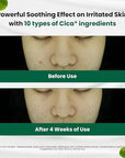 Dr.G Red Blemish Clear Soothing Korean Moisturizer Face Cream, 70ml - Cica Cream, Korean Skin Care Moisturizer, Korean Face Moisturizer, Facial Moisturizer, Korean Skincare, K Beauty Skincare Coreano